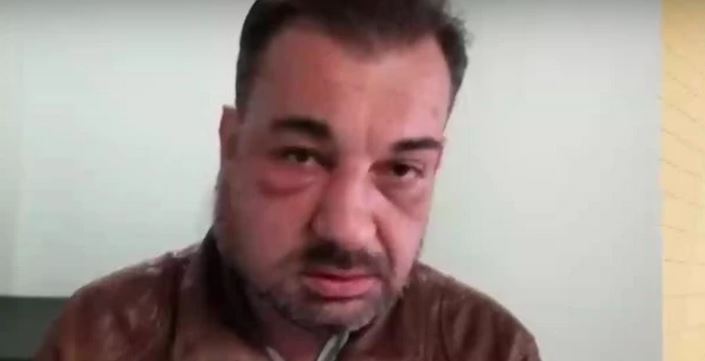 Ужас: Отвлякоха българин, пребиха го и го връзваха със свински опашки, намесени са много пари